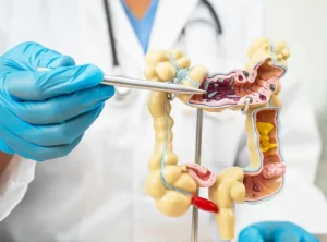 Colorectal Surgery Colorectal Surgery